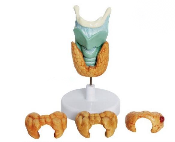 甲状腺病理模型