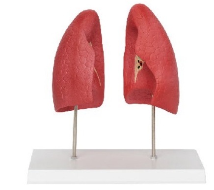 左右肺模型