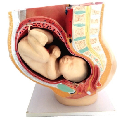 妊娠骨盆（带9月大胎儿）