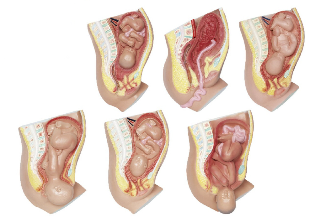 足月胎儿分娩过程（6部件