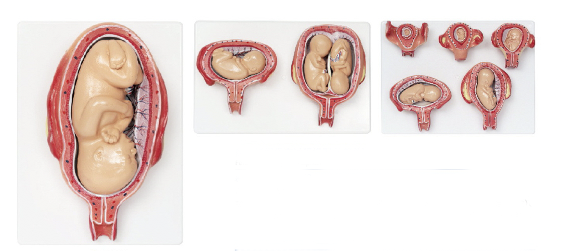 胎儿妊娠发育过程模型（8部件）