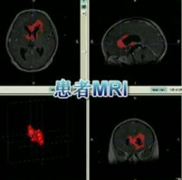MRI设备结构虚拟仿真教学系统