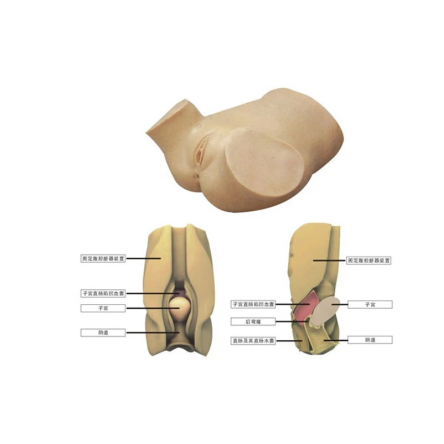 阴道后穹窿穿刺模型（JD/YQC） 新品
