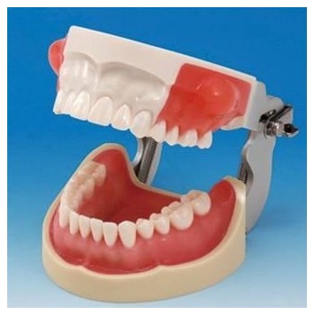 牙体预备模型